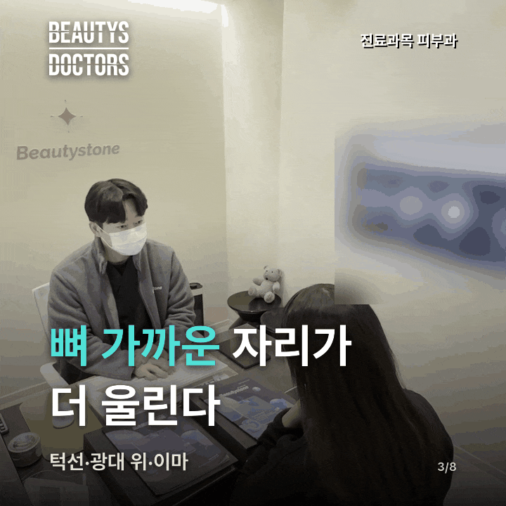 울쎄라 통증, 같은 얼굴 안에서도 자리마다 왜 다를까? 관련 이미지 2