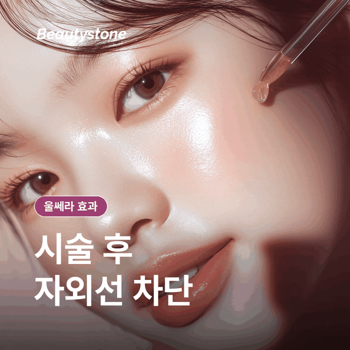 울쎄라 효과, 언제 어떻게 나타날까 관련 이미지 8