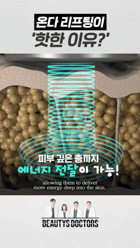 온다리프팅 효과 왜 러브핸들과 셀룰라이트에 효과적일까요? 관련 이미지 3