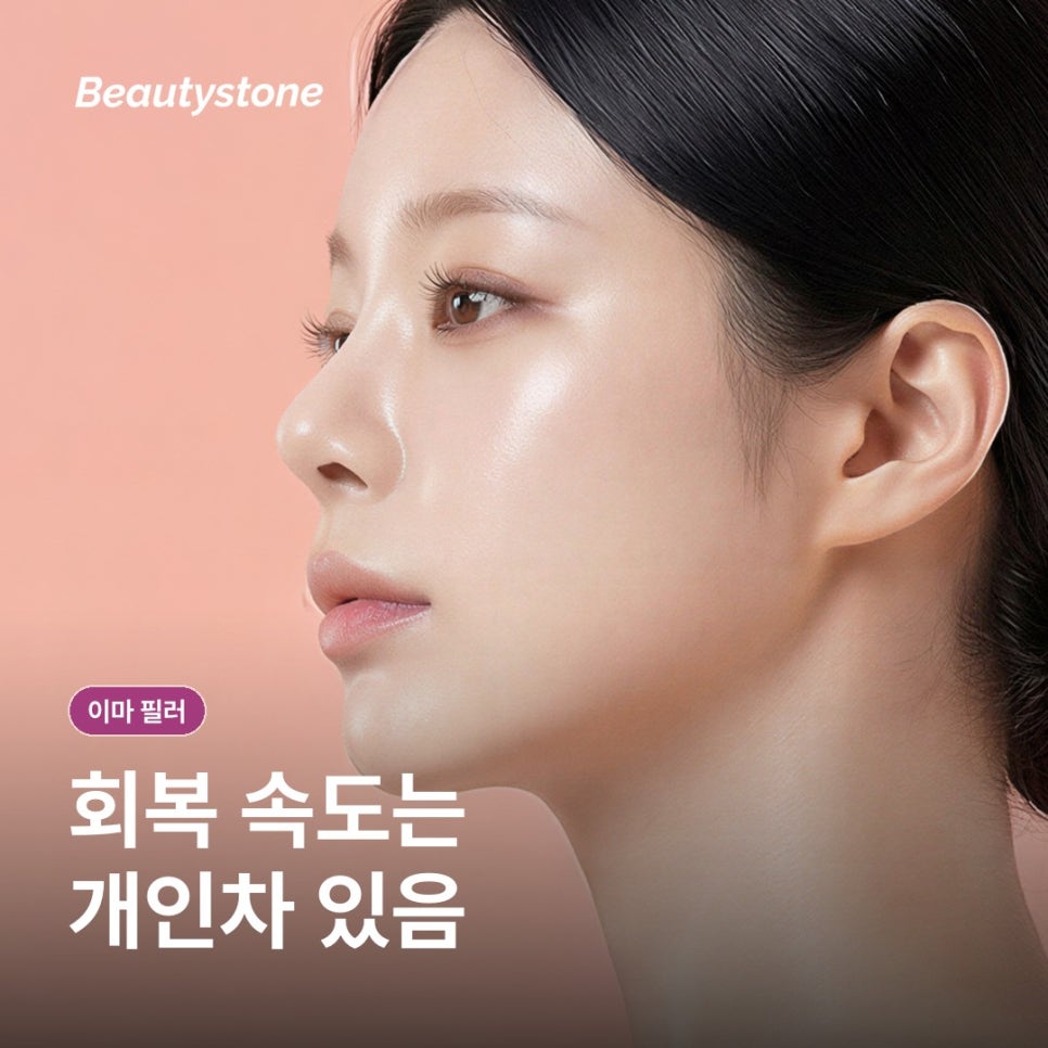 이마 필러 알아보기: 원리와 과정, 회복 관리 총정리 관련 이미지 10