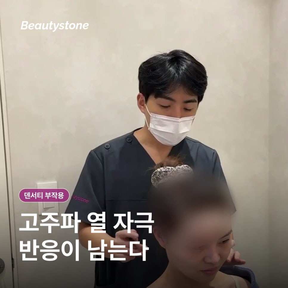 마포구청 덴서티 부작용, 화상과 볼패임은 왜 생길까요? 관련 이미지 2