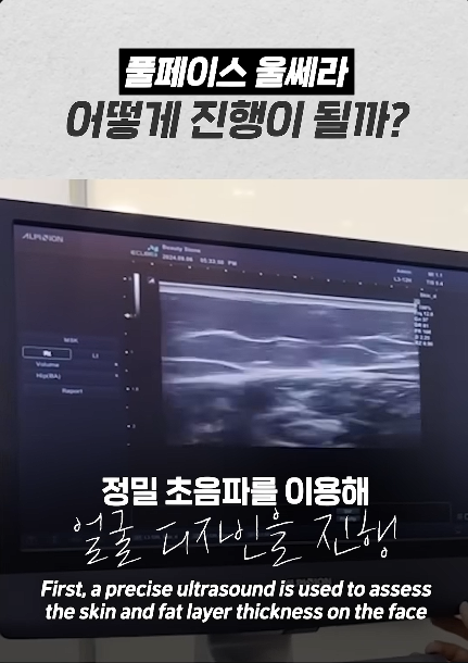 이중턱살빼는법, 얼굴 라인까지 달라지는 핵심 포인트 관련 이미지 3