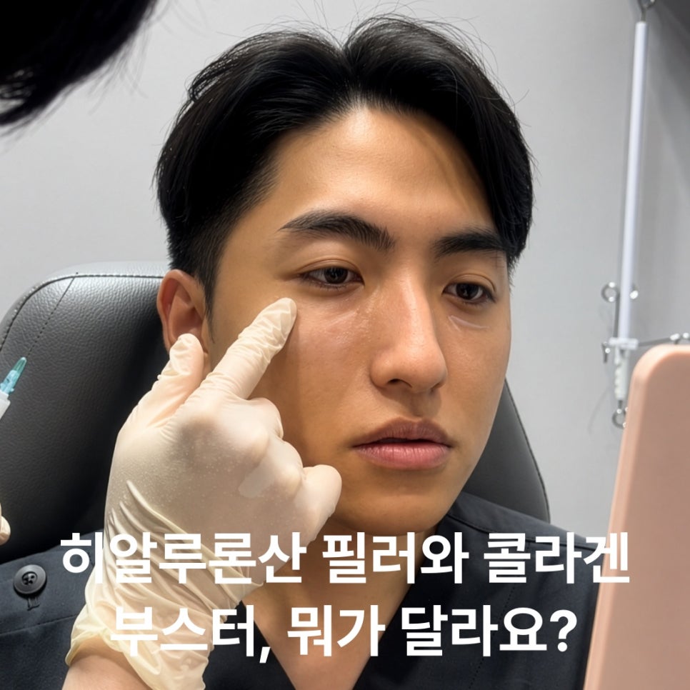 이마필러 받아볼까 했는데, 뭐부터 알면 좋을까 관련 이미지 3