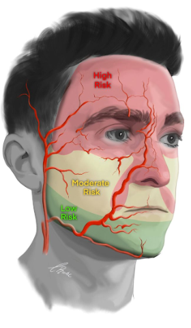 무턱필러/턱끝필러 후기, 만족도 높은 경우의 공통점 관련 이미지 2