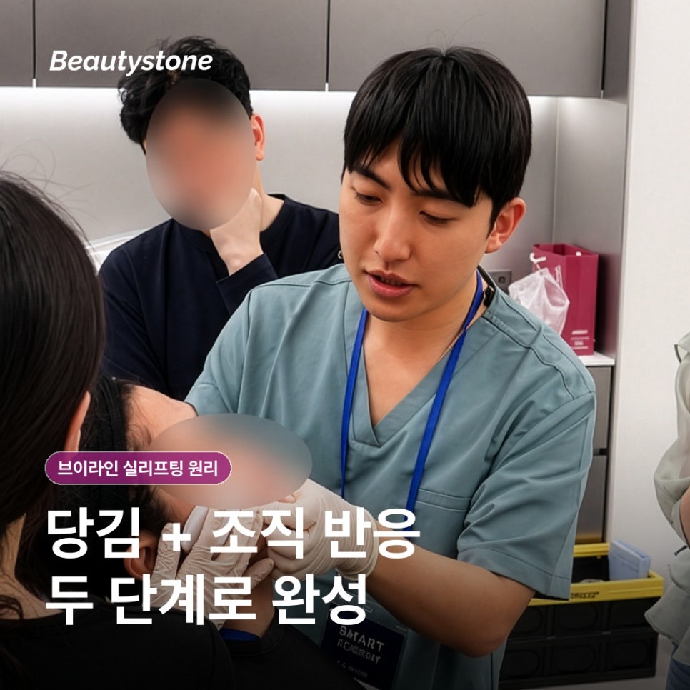 How V-Line Thread Lifting Works: What to Know Before the Procedure image 5
