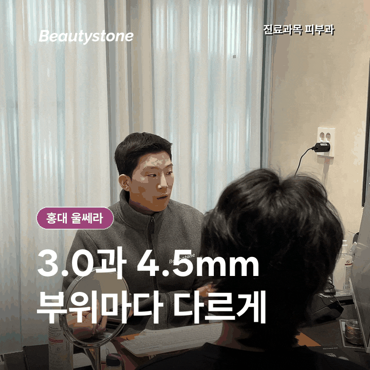 홍대 울쎄라, 300샷·400샷수보다 중요한 마킹 기준 관련 이미지 3