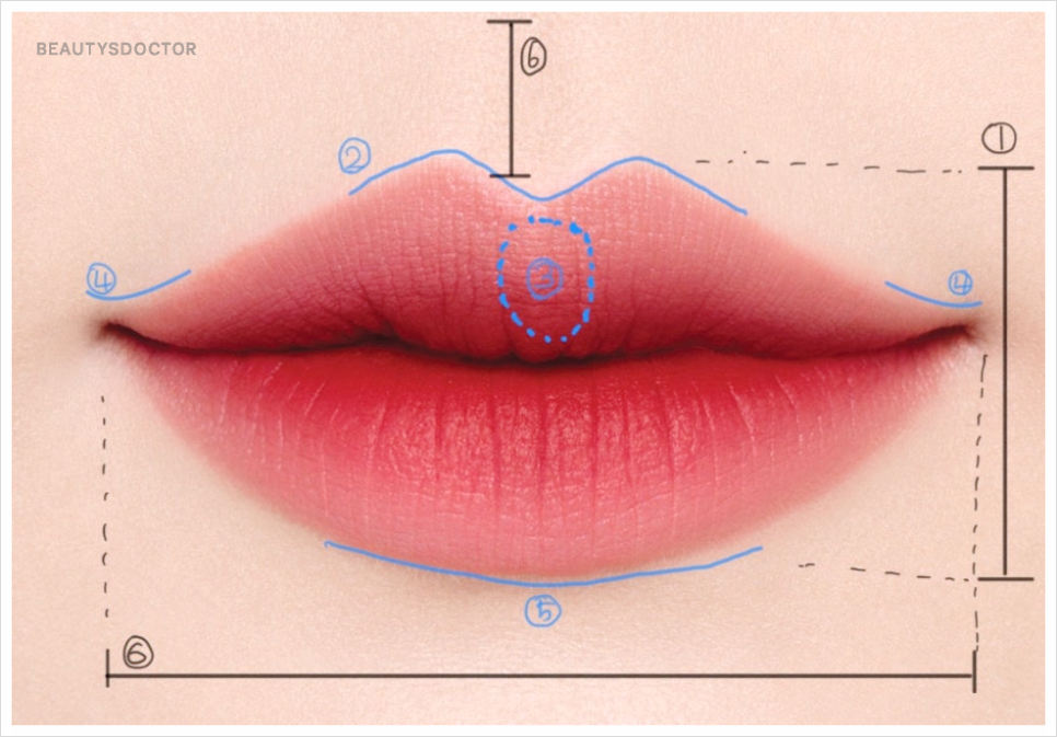 입술필러 1cc, 인중 길이 짧아보이는 이유 관련 이미지 2