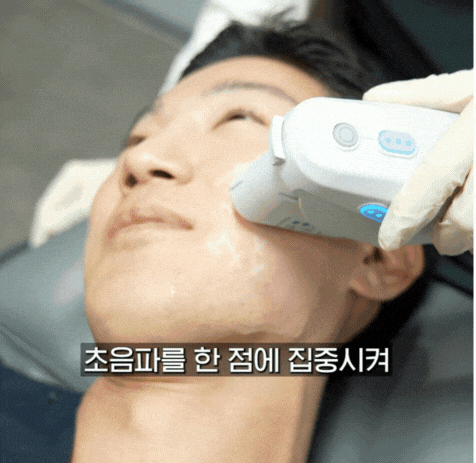 슈링크 효과와 울쎄라 효과 차이 비교 관련 이미지 2