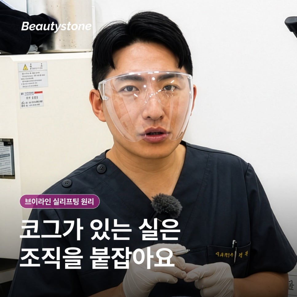 How V-Line Thread Lifting Works: What to Know Before the Procedure image 4