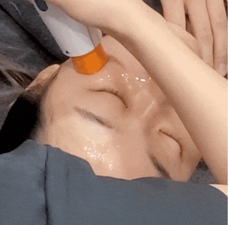 올리지오 효과 시기, 모르고 받으면 손해입니다 관련 이미지 3