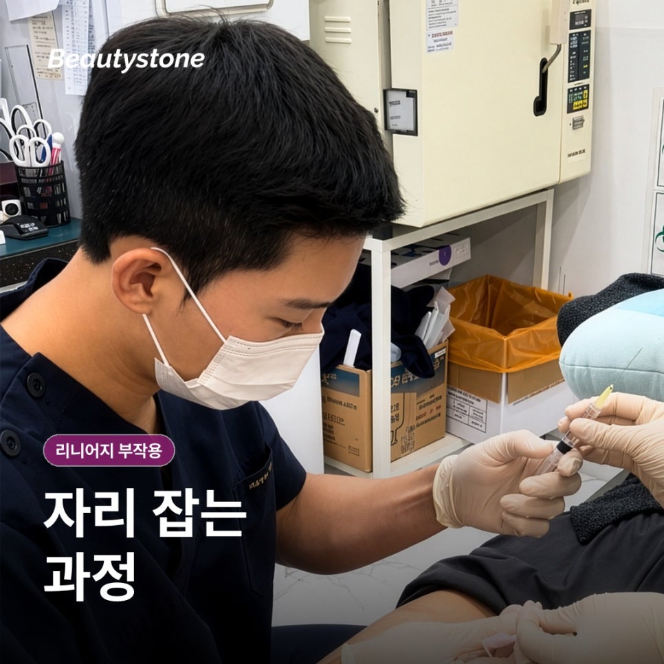 까치산역 인모드 부작용, FX 멍과 포마 열감은 어디까지 괜찮을까요? 관련 이미지 4