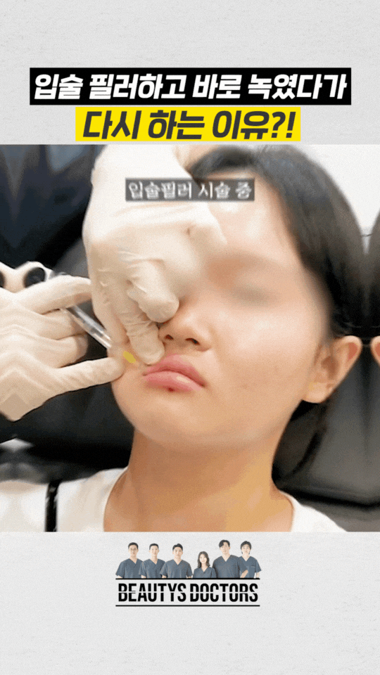 입술필러 1cc 후기, 입꼬리 보톡스와 함께하는 이유 관련 이미지 3