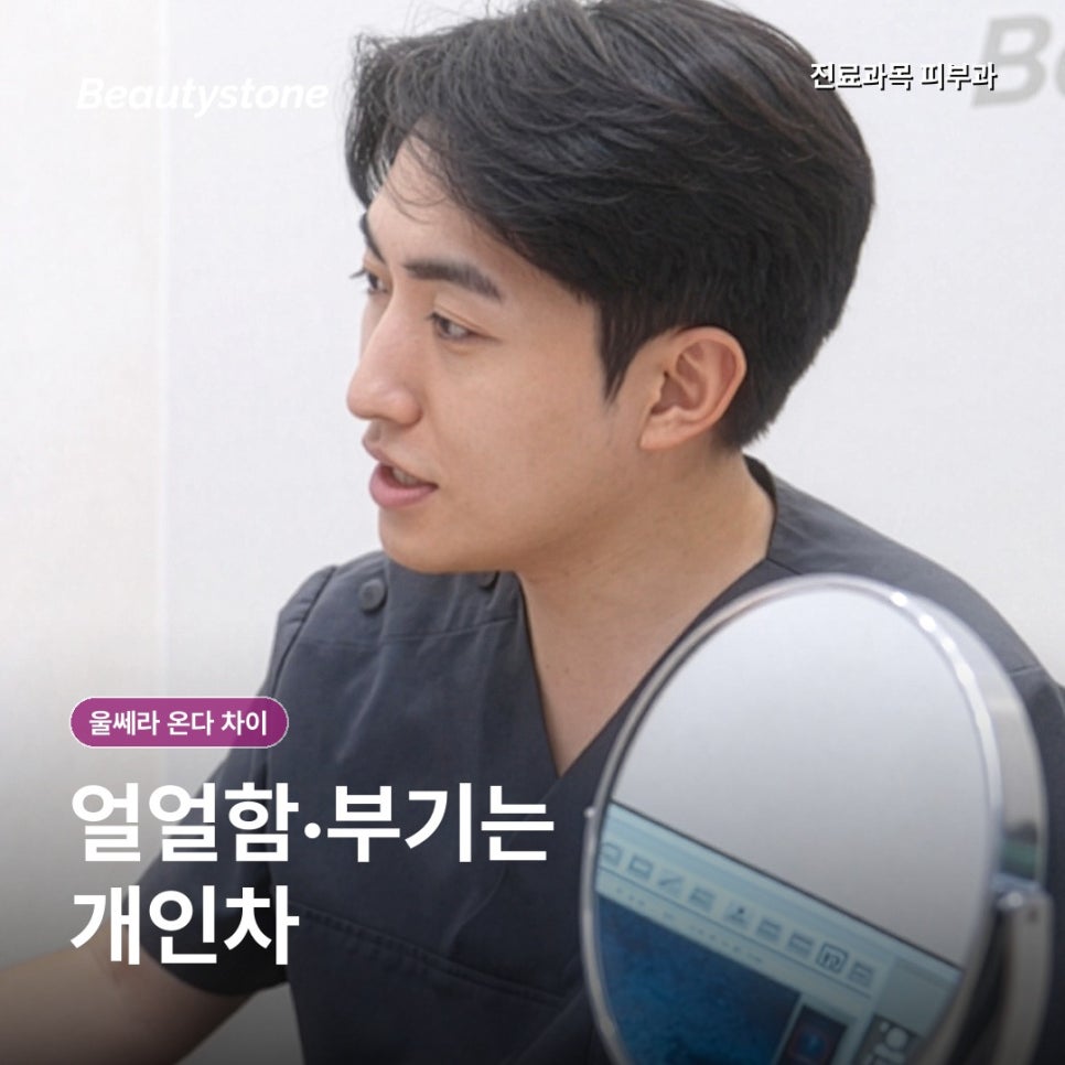 울쎄라 온다 차이, 얼굴살이 적다면 선택이 달라집니다 관련 이미지 6