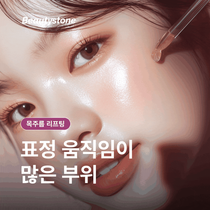 목주름 리프팅, 원리와 현실적인 기대치 알아보기 관련 이미지 3