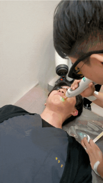 남자수염레이저제모 1회차, 실패없이 받는 법 관련 이미지 4