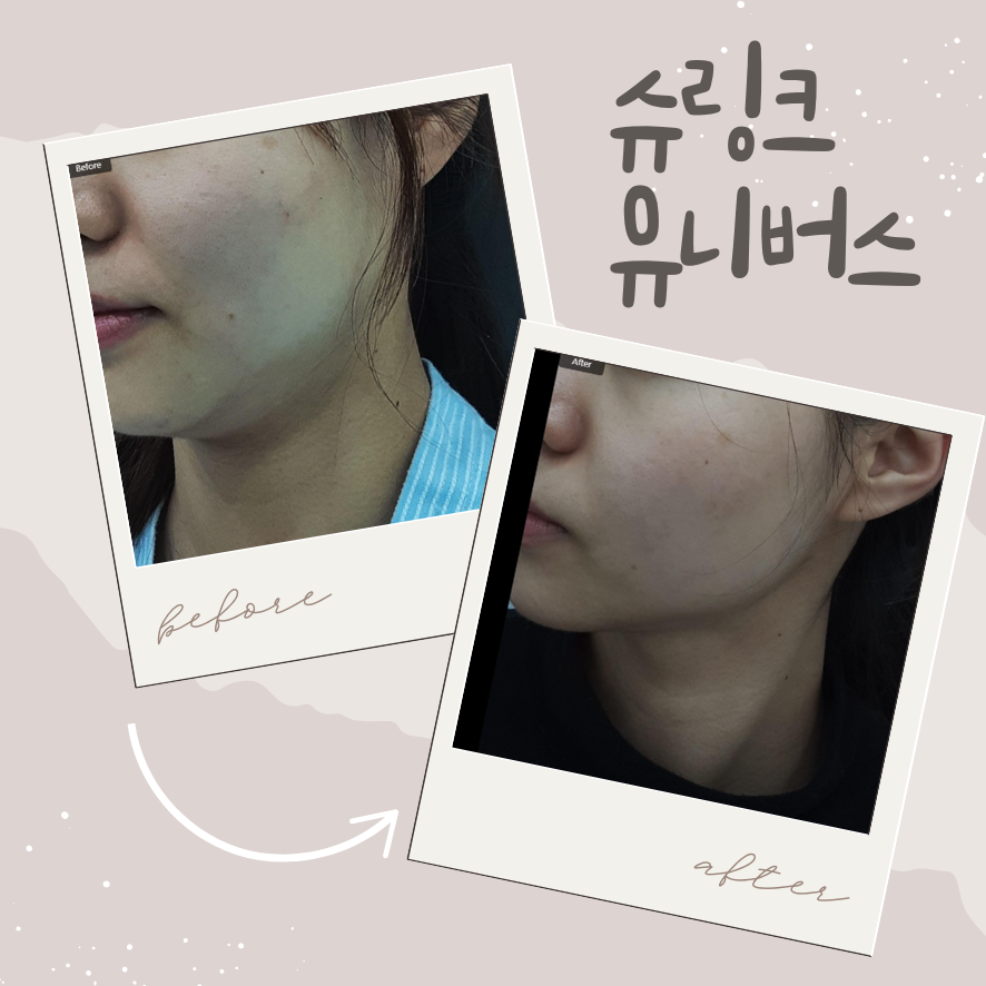 슈링크 유니버스 300샷 효과 시기와 유지기간 정리 관련 이미지 1