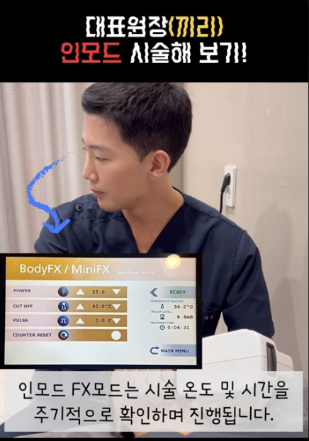 인모드 FX vs 포마 차이, 효과 없는 이유? 시술주기가 더 중요합니다 관련 이미지 4