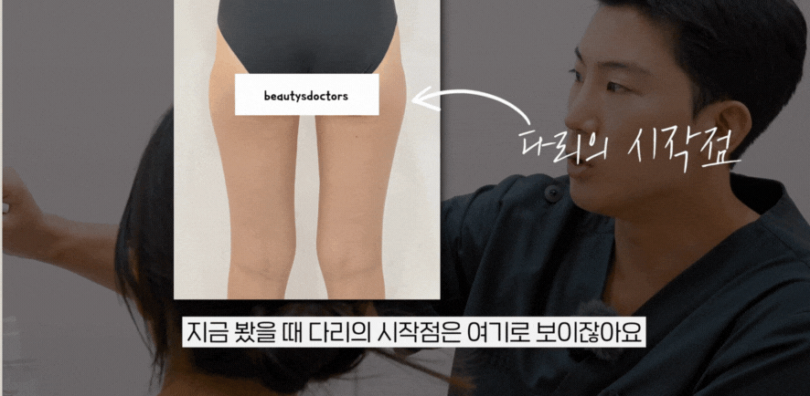 홍대 피부과 힙딥 + 엉덩이 필러로 길어진 다리 라인 관련 이미지 4