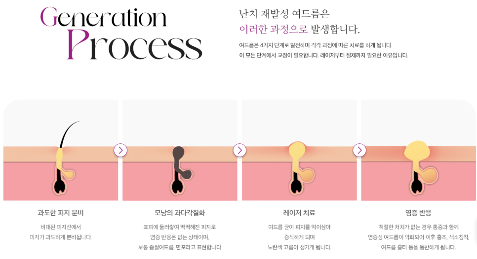 강서구피부과추천 염증주사 후기 관련 이미지 5