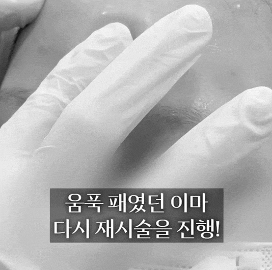 파주 피부과 이마필러 잘하는 곳, 후기를 통해 알아보 관련 이미지 2