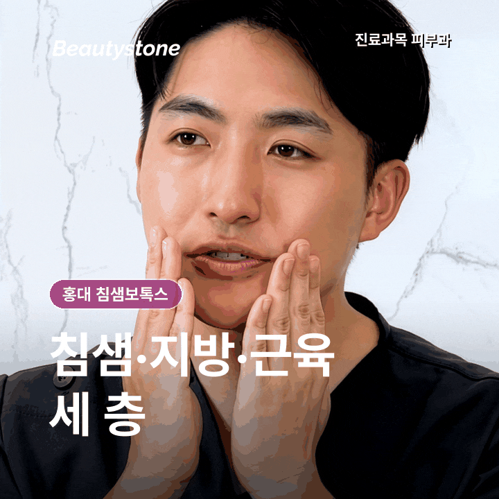 홍대 침샘보톡스 효과 없었다면, 턱 밑이 살인지 침샘인지부터 확인하세요 관련 이미지 4