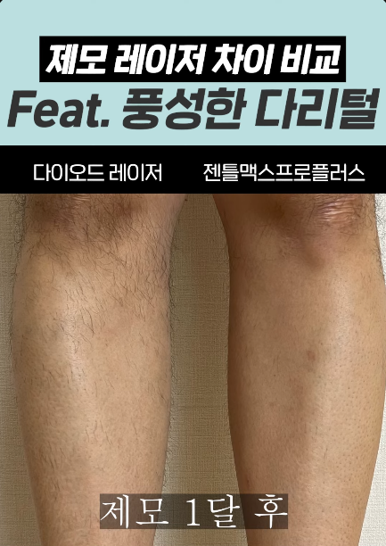 홍대입구역 피부과 남자다리털 제모, 반복 없이 줄이는 핵심 관련 이미지 5