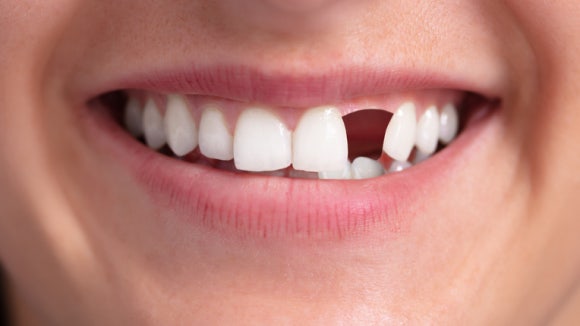 등촌치과 임플란트 하기 전 알아두면 좋을 치과 선택 기준 관련 이미지 2