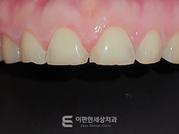 강서구화곡동라미네이트, 꼭 살펴봐야 할 부분은? 관련 이미지 5