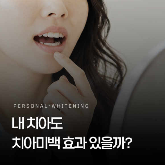 Seoul Teeth Whitening Dental Clinic: In These Cases, You May Be More Likely to See Results! (Candidates for Whitening) image 1