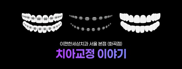 화곡동교정치과 심한 앞니 돌출, 교정이 필요한 이유는? 관련 이미지 1