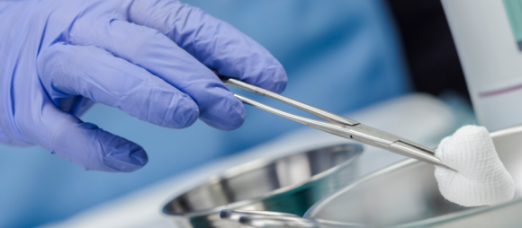 사랑니 지혈 안됨 대처법과 주의사항 총정리 관련 이미지 2