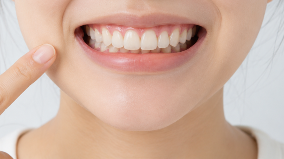 Hwagok Bon-dong Teeth Alignment: My Upper Teeth Cover My Lower Teeth! Can Orthodontic Treatment Improve an Overbite? image 5