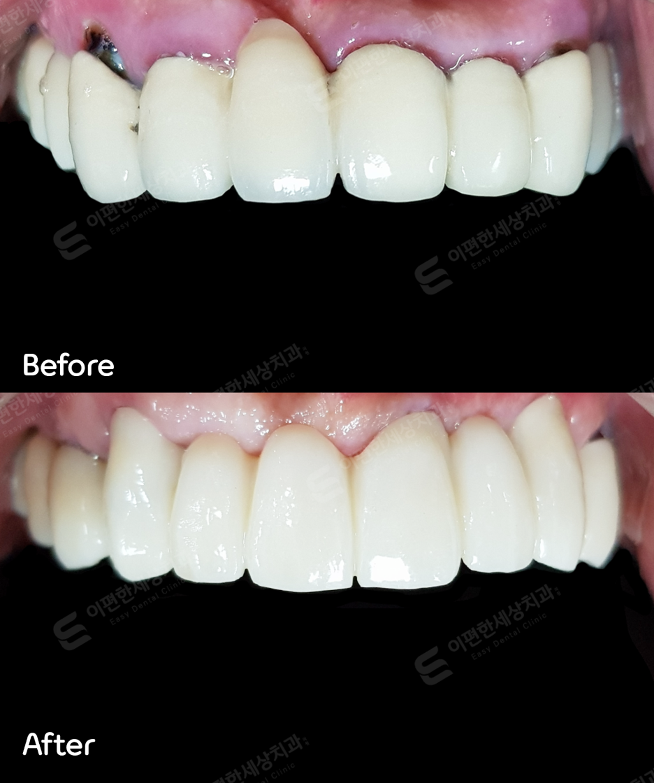 강서구임플란트, 치과 선택? 고민된다면 읽어보세요. 관련 이미지 9