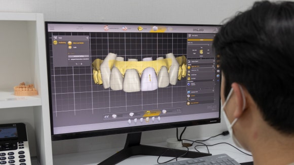 이제 원내 기공소 없이 보철물 못 만듭니다. 관련 이미지 1
