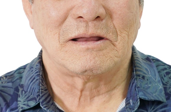 서울강서구임플란트, 고령 환자라면 꼭 확인해야 할 내용 관련 이미지 1