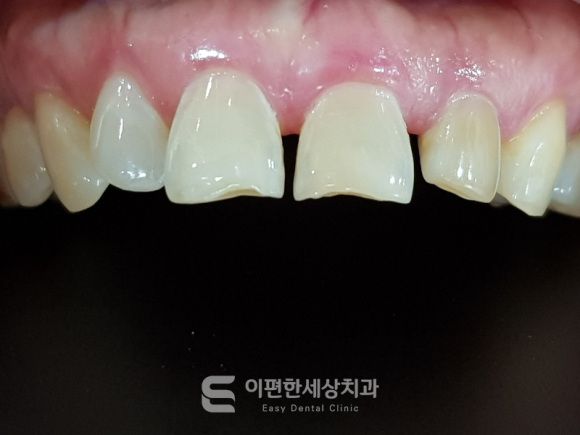 강서구화곡동라미네이트, 꼭 살펴봐야 할 부분은? 관련 이미지 4