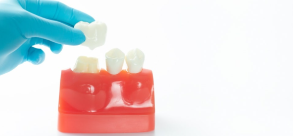 크라운 치아 통증, 아픈 이유? 무엇일까요? 관련 이미지 1