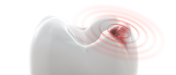 아랫니 시림, 3가지 원인일 확률이 높습니다! 관련 이미지 3