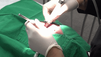 화곡본동치과 2025년 끝나기 전 스케일링 꼭 받아야 하는 이유 관련 이미지 6