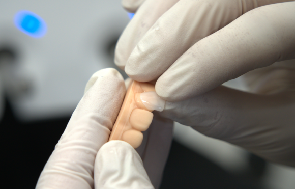 서울화곡동치과 라미네이트 이 기준으로 해야 후회 없습니다 관련 이미지 2