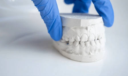 화곡동치아교정 한 번에 성공하고 싶다면 이걸 기억하세요 관련 이미지 2