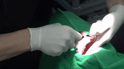 화곡동치아교정 한 번에 성공하고 싶다면 이걸 기억하세요 관련 이미지 8