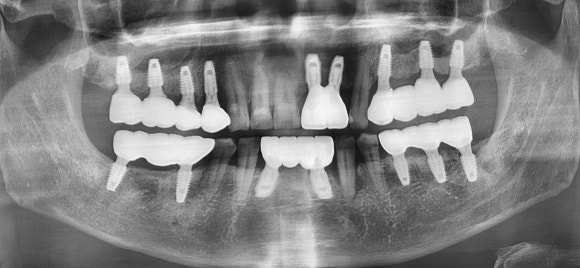 How Should You Choose a Gangseo Implant Dental Clinic? image 5