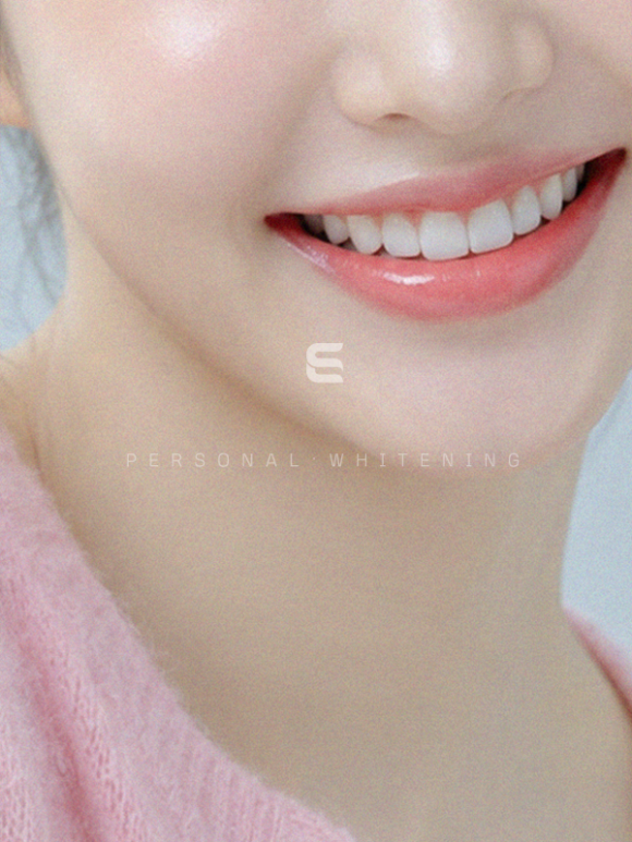 Dental Clinic for Teeth Whitening in Gangseo-gu, Seoul: Why Consider Your Tooth Color but Not Your Skin Tone? image 3