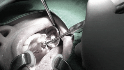 등촌역치과 임플란트 비용 사람마다 다 다른 이유 관련 이미지 2