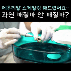 화곡본동치과 2025년 끝나기 전 스케일링 꼭 받아야 하는 이유 관련 이미지 4