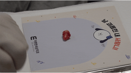 Seoul Implant: Worried About Wisdom Tooth Extractions? (ft. Conscious Sedation) image 6