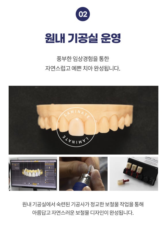 라미네이트 치과 선택? 고민된다면 읽어보세요. 관련 이미지 6