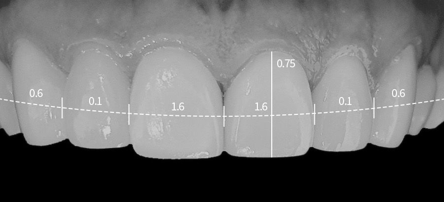 What to Consider When Choosing a Laminate Dentistry Clinic in Hwagok, Seoul image 3