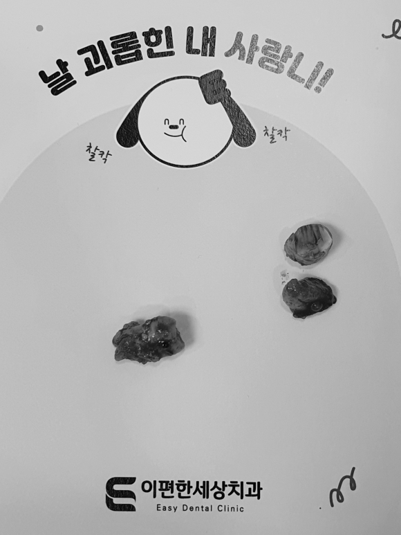 강서구사랑니 전문 치과 찾는 방법 알려드릴게요 관련 이미지 3